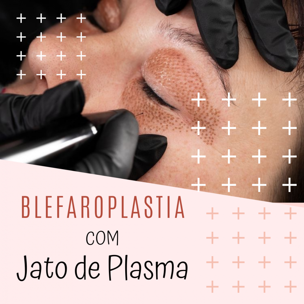 Blefaroplastia Com Jato De Plasma Orion Clinical Est Tica